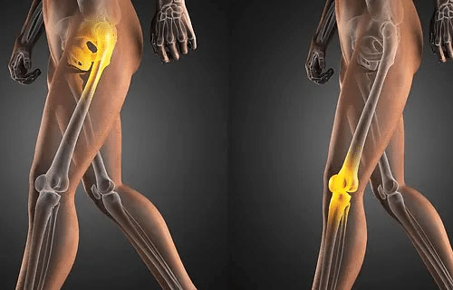 Joint Pain Treatment